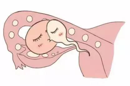 关于包生男孩试管机构